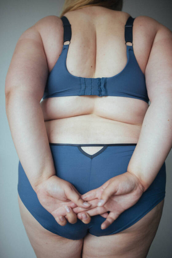 Society Taught Me to be Fatphobic